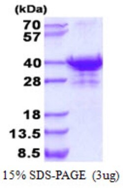 Novus Biologicals&trade;&nbsp;Recombinant Human UTP23 His Protein