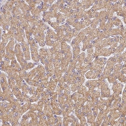 UTP23 Antibody, Novus Biologicals:Antibodies:Primary Antibodies