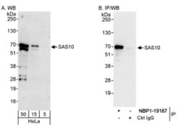 UTP3 Antibody, Novus Biologicals 0.1mL; Unlabeled:Antibodies, Polyclonal