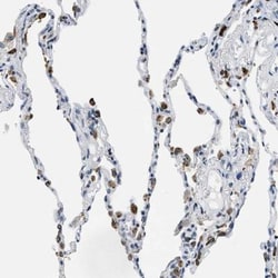 UVRAG Antibody, Novus Biologicals 25 &mu;L; Unlabeled:Antibodies, Polyclonal