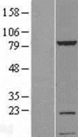 Novus Biologicals&trade;&nbsp;UVSSA Overexpression Lysate