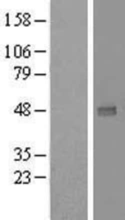 Novus Biologicals&trade;&nbsp;UXS1 Overexpression Lysate