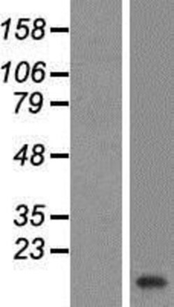 Novus Biologicals&trade;&nbsp;VAMP-2 Overexpression Lysate