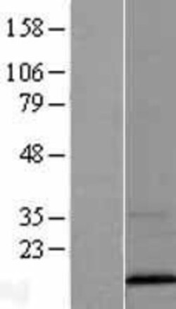 Novus Biologicals&trade;&nbsp;VAMP3/Cellubrevin Overexpression Lysate