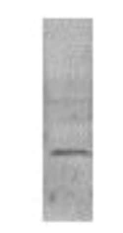 VAMP3/Cellubrevin Antibody, Novus Biologicals 0.1mg; Unlabeled:Antibodies,