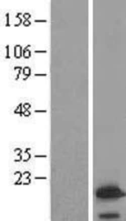 Novus Biologicals™ VAMP4 Overexpression Lysate