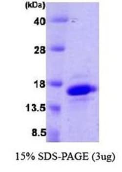 Novus Biologicals&trade;&nbsp;Recombinant Human VAMP4 His Protein