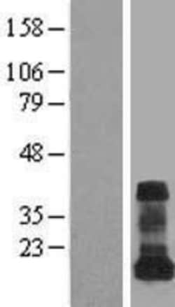 Novus Biologicals&trade;&nbsp;VAMP-5 Overexpression Lysate