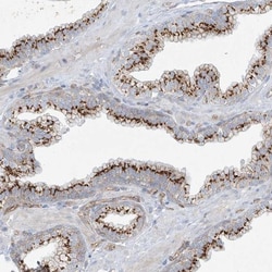 VAMP-5 Antibody, Novus Biologicals 25 &mu;L; Unlabeled:Antibodies, Polyclonal