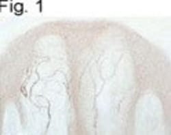 Vanilloid R1/TRPV1 Antibody, Novus Biologicals:Anticuerpos:Anticuerpos