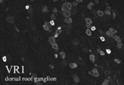 anti-Vanilloid R1/TRPV1, Polyclonal, Novus Biologicals 0.05mL; Unlabeled:Antibodies,