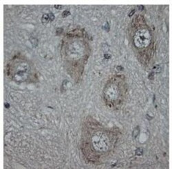 Vanilloid R1/TRPV1 Antibody, Novus Biologicals 0.1 mL; Unconjugated:Antibodies,
