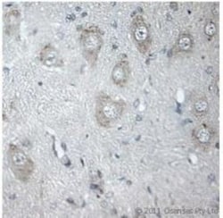 Vanilloid R1/TRPV1 Antibody, Novus Biologicals 0.1 mL; Unconjugated:Antibodies,