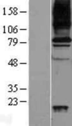 Novus Biologicals&trade;&nbsp;VAP-1/AOC3 Overexpression Lysate