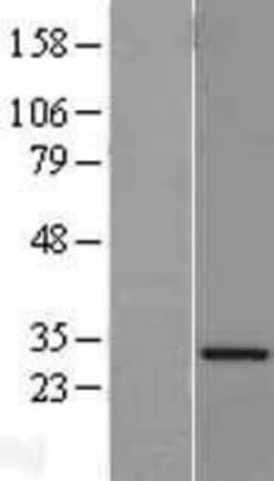 Novus Biologicals&trade;&nbsp;VAP-A Overexpression Lysate