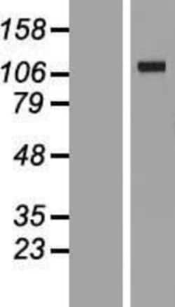 Novus Biologicals&trade;&nbsp;VARS2 Overexpression Lysate