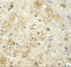 Vasohibin Antibody - BSA Free, Novus Biologicals 0.1mg; Unlabeled:Antibodies,