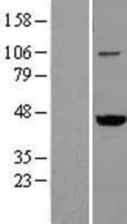 Novus Biologicals&trade;&nbsp;VAT1 Overexpression Lysate
