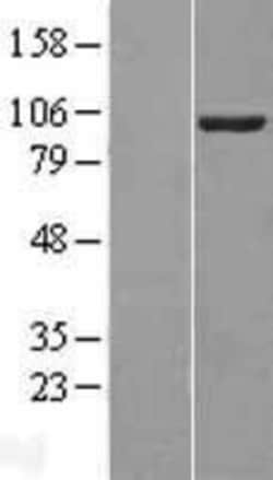 Novus Biologicals&trade;&nbsp;VAV2 Overexpression Lysate