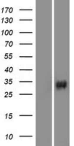 Novus Biologicals&trade;&nbsp;VAV3 Overexpression Lysate