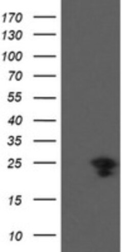 VBP1 Antibody (OTI2E6), Novus Biologicals 0.1mL; Unlabeled:Antibodies,