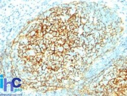 VCAM-1/CD106 Antibody (1.4C3), Novus Biologicals:Antibodies:Primary Antibodies