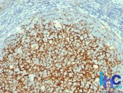 VCAM-1/CD106 Antibody (1.4C3), Novus Biologicals:Antibodies:Primary Antibodies
