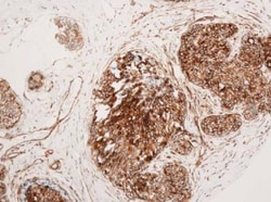 VCAM-1/CD106 Antibody (6G9) - BSA Free, Novus Biologicals 0.1mL; Unlabeled:Antibodies,