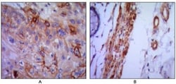 VCAM-1/CD106 Antibody (6G9) - BSA Free, Novus Biologicals 0.1mL; Unlabeled:Antibodies,