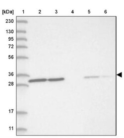 VDAC1 Antibody, Novus Biologicals 0.1mL; Unlabeled:Antibodies, Polyclonal