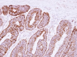 VDAC2 Antibody, Novus Biologicals 0.1mL; Unlabeled:Antibodies, Polyclonal