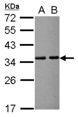 VDAC2 Antibody, Novus Biologicals 0.1mL; Unlabeled:Antibodies, Polyclonal