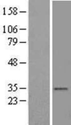Novus Biologicals&trade;&nbsp;VDAC2 Overexpression Lysate
