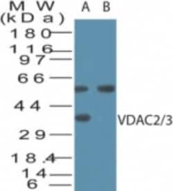 VDAC2/3 Antibody, Novus Biologicals 0.025mg; Unlabeled:Antibodies, Polyclonal