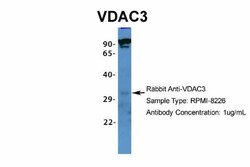 VDAC3 Antibody, Novus Biologicals:Antibodies:Primary Antibodies