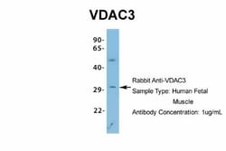 VDAC3 Antibody, Novus Biologicals 0.05mg; Unlabeled:Antibodies, Polyclonal