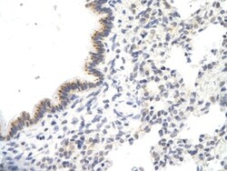 VDAC3 Antibody, Novus Biologicals 0.05mg; Unlabeled:Antibodies, Polyclonal