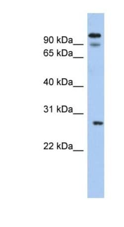 VDAC3 Antibody, Novus Biologicals:Antibodies:Primary Antibodies