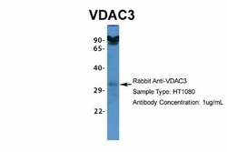 VDAC3 Antibody, Novus Biologicals:Antibodies:Primary Antibodies