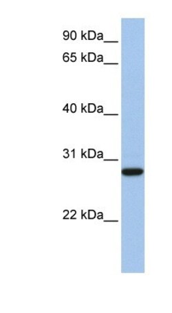 VDAC3 Antibody, Novus Biologicals 0.05mg; Unlabeled:Antibodies, Polyclonal
