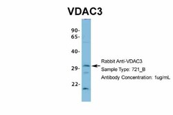 VDAC3 Antibody, Novus Biologicals 0.05mg; Unlabeled:Antibodies, Polyclonal