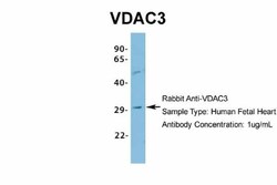 VDAC3 Antibody, Novus Biologicals 0.05mg; Unlabeled:Antibodies, Polyclonal