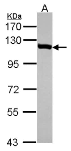 VDP p115 Antibody, Novus Biologicals 0.1mL; Unlabeled:Antibodies, Polyclonal