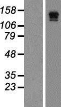 Novus Biologicals&trade;&nbsp;VEGFR3/Flt-4 Overexpression Lysate