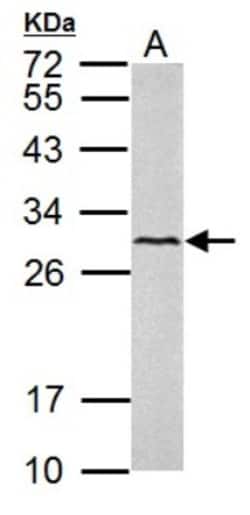 VEGF-C Antibody, Novus Biologicals 0.1mL; Unlabeled:Antibodies, Polyclonal