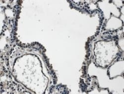 VEGF-C Antibody, Novus Biologicals 0.025 mg; Unconjugated:Antibodies, Polyclonal