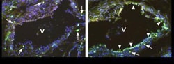 VEGFR1/Flt-1 Rabbit anti-Human, Polyclonal, Novus Biologicals 0.02 mg;