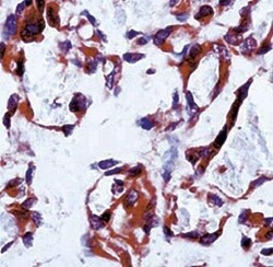VEGFR1/Flt-1 Antibody, Novus Biologicals 0.5 mL; Unconjugated:Antibodies,