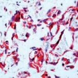 VEGFR1/Flt-1 Antibody, Novus Biologicals 0.5 mL; Unconjugated:Antibodies,