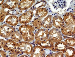 VEGFR2/KDR/Flk-1 Antibody (1B6) - BSA Free, Novus Biologicals 0.1mg; Unlabeled:Antibodies,
